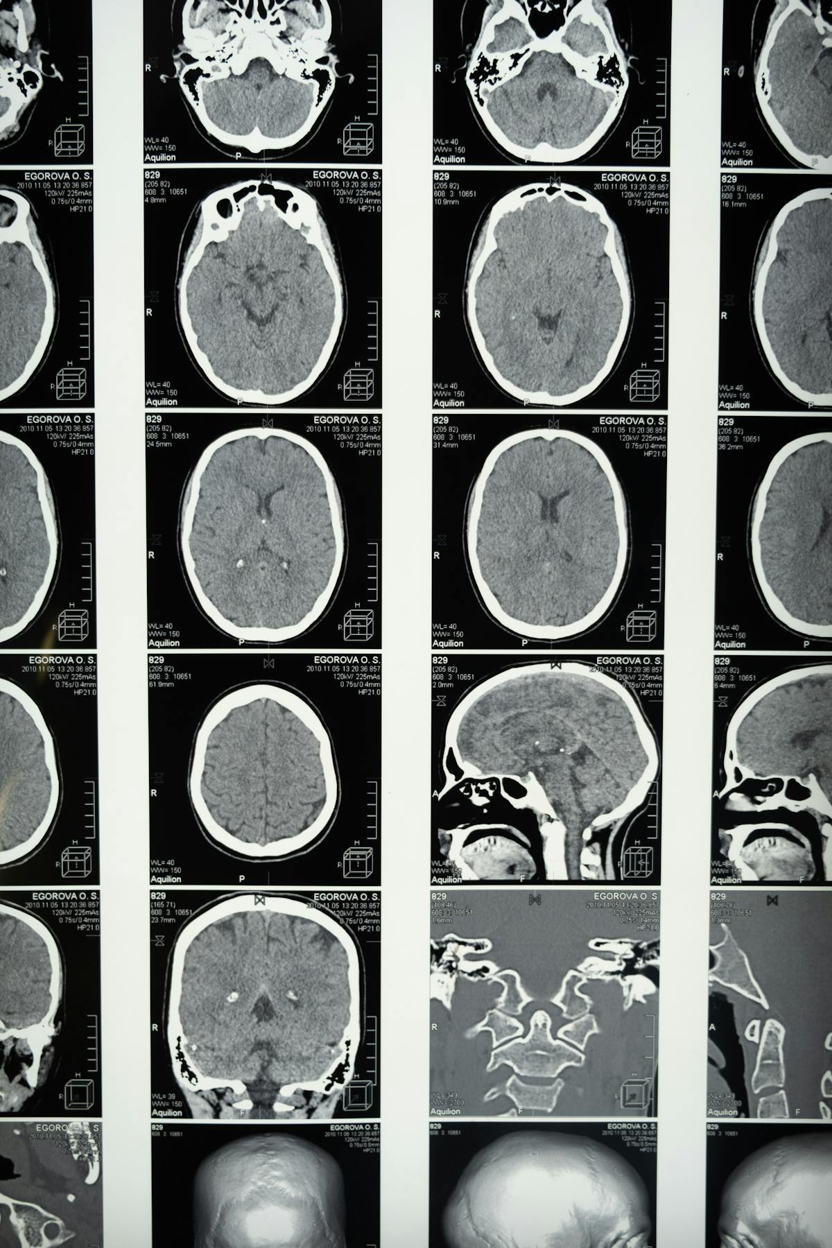 Brain Health & Cognitive Optimization